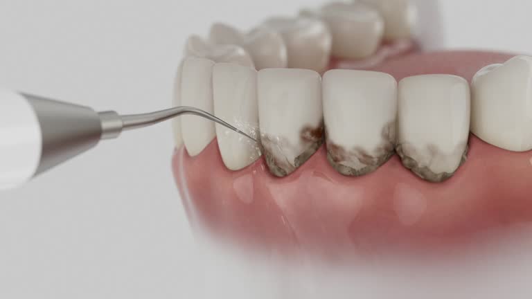 Trusted Emergency Dentist service in Morton, IL - Dentist Open Now